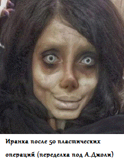 пластическая операция до и после