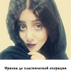 пластическая операция до и после